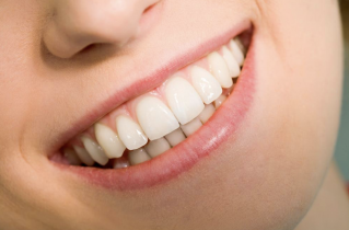 Close Up of a Smiling Woman with Perfect Teeth